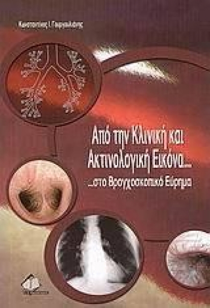 Από την κλινική και ακτινολογική εικόνα ...στο βρογχοσκοπικό εύρημα