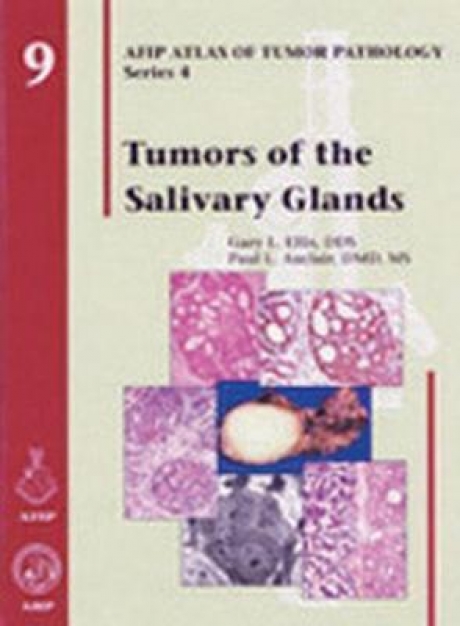 Tumors of the Salivary Glands, 1st Edition