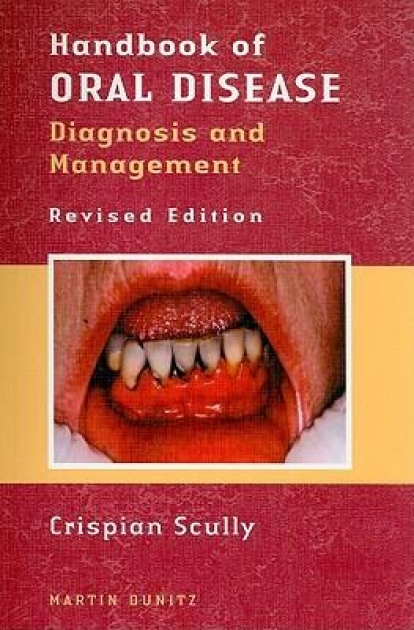 Handbook of Oral Disease : Diagnosis and Management, 1st Edition