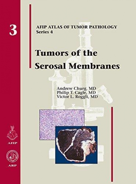 Tumors of the Serosal Membranes, 1st Edition