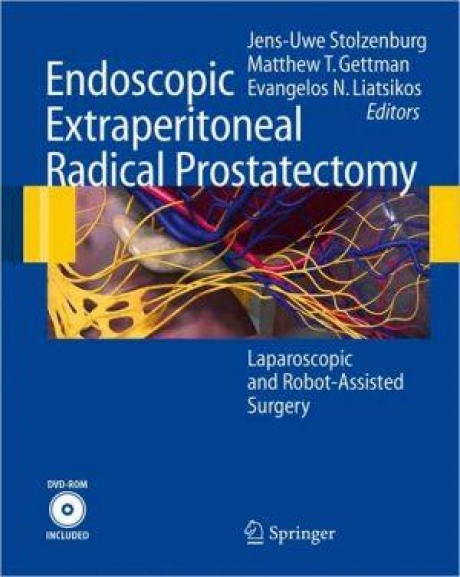 Endoscopic Extraperitoneal Radical Prostatectomy : Laparoscopic and Robot-assisted Surgery