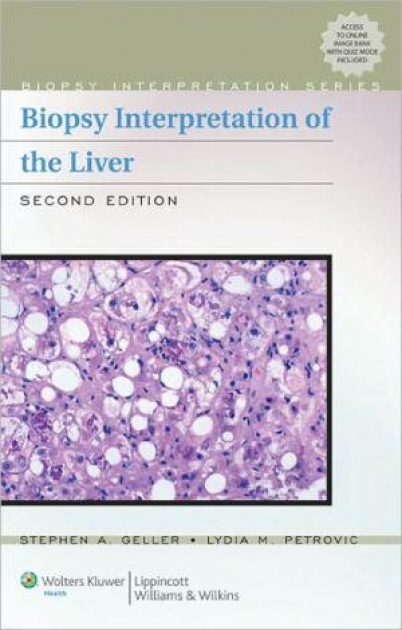 Biopsy Interpretation of the Liver, 2nd Edition