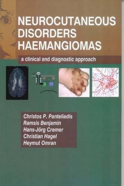Neurocutaneous Disorders - Hemangomas: A Clinical and Diagnostic Approach, 1st Edition