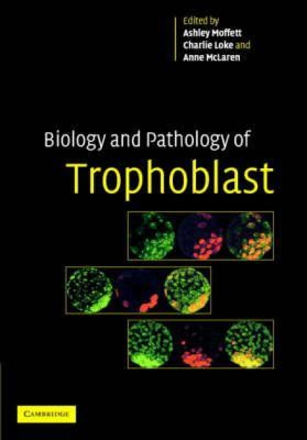 Biology and Pathology of Trophoblast, 1st Edition