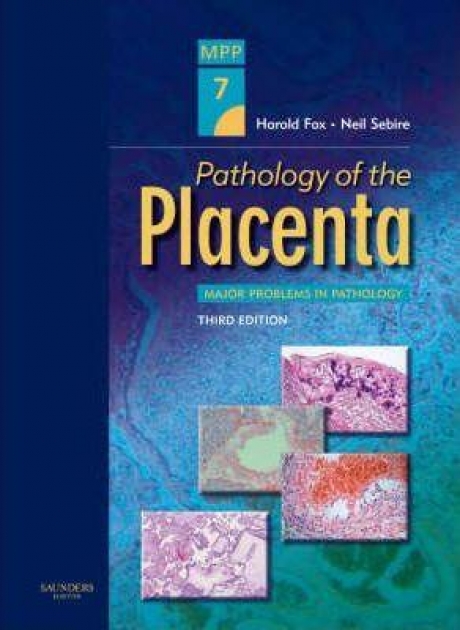 Pathology of the Placenta, 3rd Edition