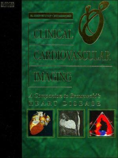 Clinical Cardiovascular Imaging: Companion to Braunwald`s Heart Disease, 1st Edition