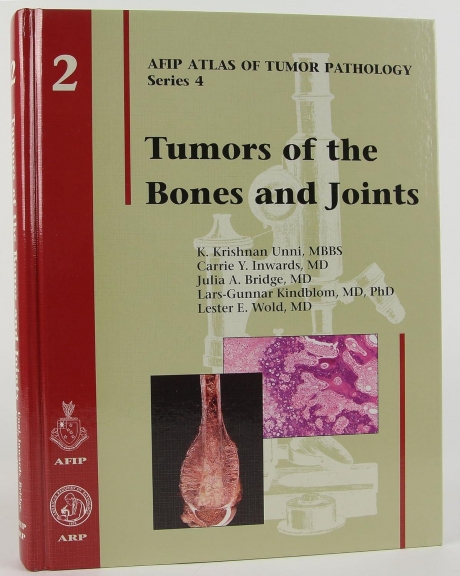 Tumors of the Bones and Joints