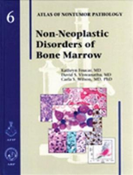 Non-Neoplastic Diseases of Bone Marrow, 1st Edition
