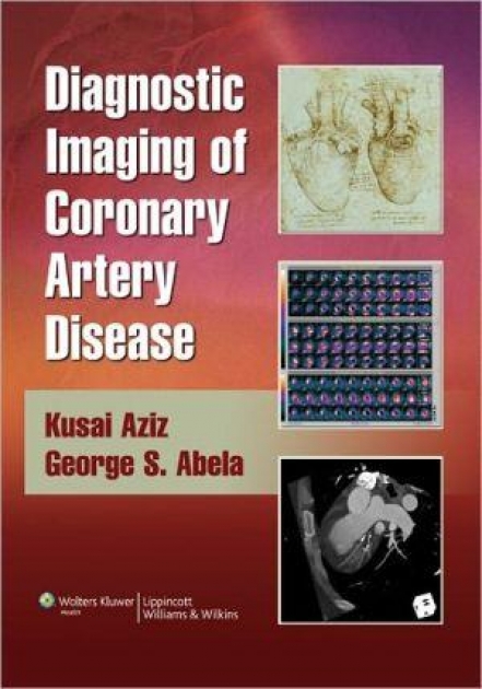 Diagnostic Imaging of Coronary Artery Disease, 1st Edition