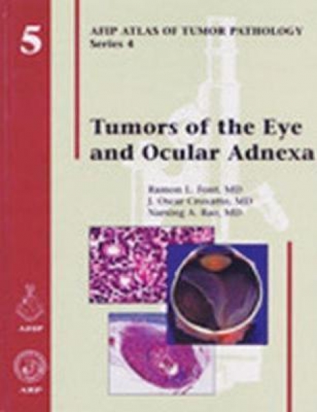 Tumors of the Eye and Ocular Adnexa, 1st Edition