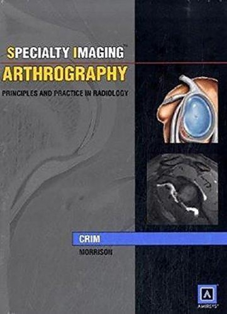 Specialty Imaging: Arthrography : Principles and Practice in Radiology (Published by Amirsys), 1st Edition