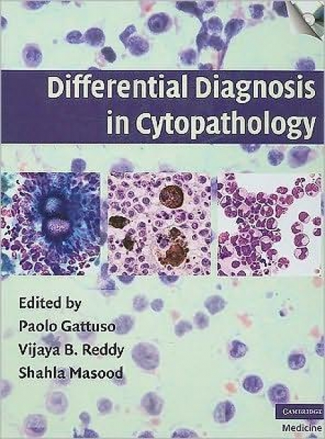 Differential Diagnosis in Cytopathology with CD-ROM, 1st Edition