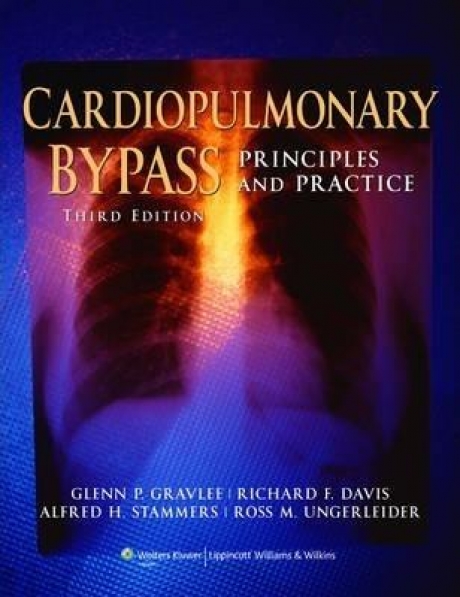 Cardiopulmonary Bypass : Principles and Practice, 3rd Edition