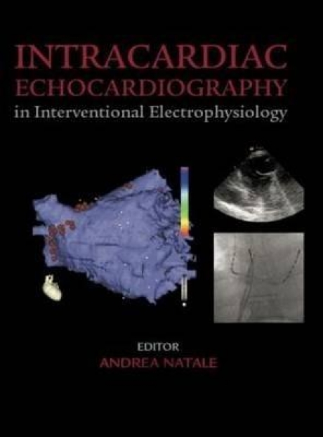 Intracardiac Echocardiography in Interventional Electrophysiology: Adv. Mngmt of Atrial Fibrillation&Ventr. Tach., 1st Edition