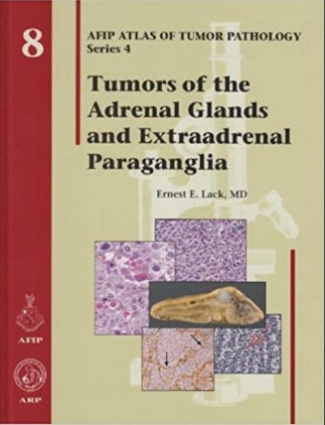 Tumors of the Adrenal Glands and Extraadrenal Paraganglia