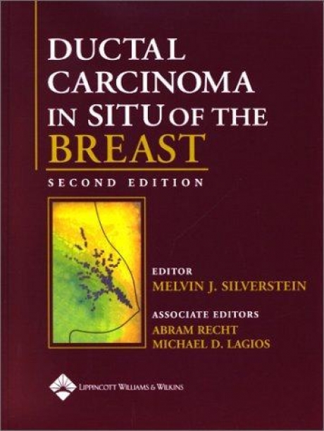 Ductal Carcinoma in Situ of the Breast, 2nd Edition