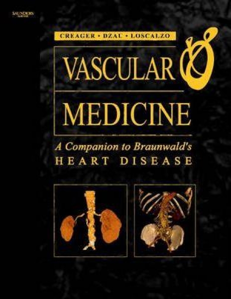 Vascular Medicine: A Companion to Braunwald`s Heart Disease: A Companion to \"Braunwald`s Heart Disease\", 1st Edition