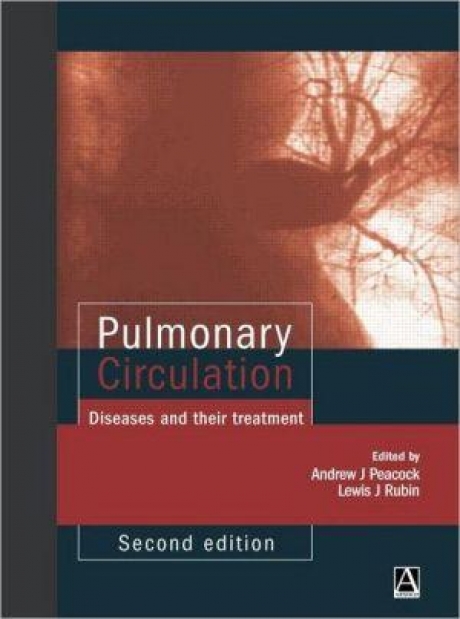 Pulmonary Circulation, 2nd edition: Diseases and their treatment, 2nd Edition