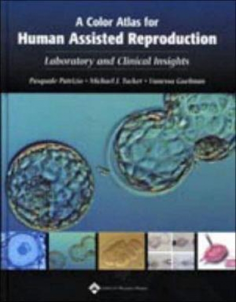 A Color Atlas for Human Assisted Reproduction : Laboratory and Clinical Insights, 1st Edition