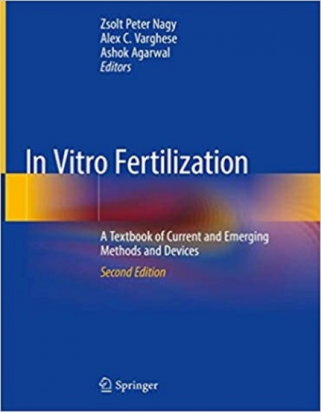 In Vitro Fertilization