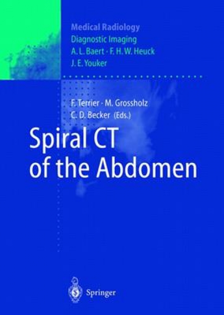 Spiral CT of the Abdomen, 1st Edition