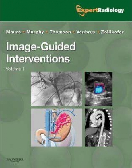 Image-Guided Interventions, 1st Edition