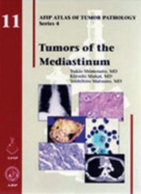 Tumors of the Mediastinum, 1st Edition