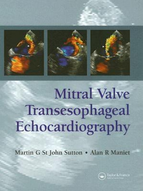 Mitral Valve Transesophageal Echocardiography, 1st Edition