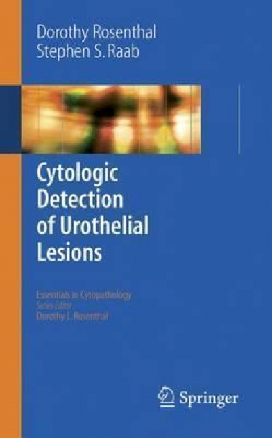 Cytologic Detection of Urothelial Lesions, 1st Edition