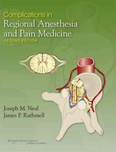 Complications in Regional Anesthesia and Pain Medicine, 2nd Edition