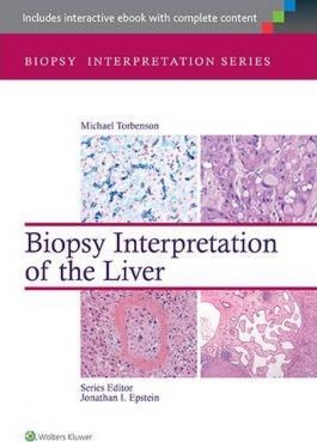 Biopsy Interpretation of the Liver, 3rd Edition