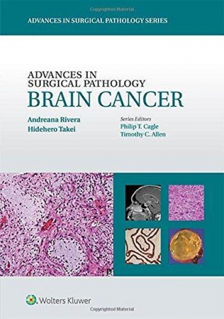 Advances in Surgical Pathology: Brain Cancer, 1st Edition
