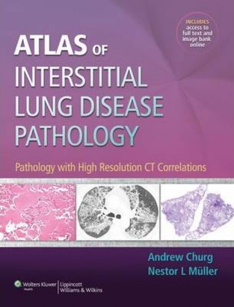 Atlas of Interstitial Lung Disease Pathology: Pathology with High Resolution CT Correlations, 1st Edition