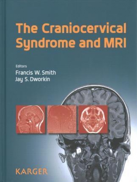 The Craniocervical Syndrome and MRI, 1st Edition