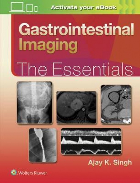 Gastrointestinal Imaging: The Essentials, 1st Edition