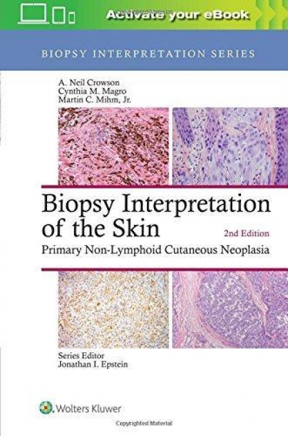 Biopsy Interpretation of the Skin : Primary Non-Lymphoid Cutaneous Neoplasia, 2nd Edition