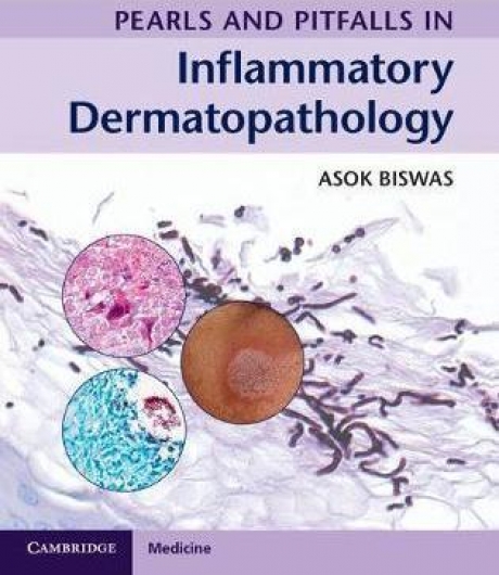 Pearls and Pitfalls in Inflammatory Dermatopathology, 1st Edition