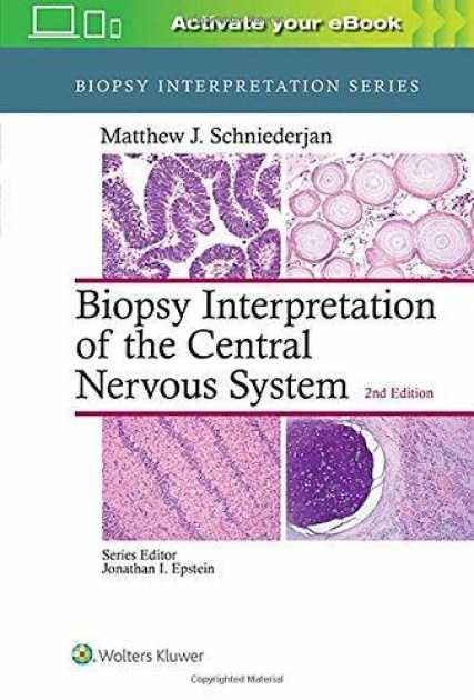 Biopsy Interpretation of the Central Nervous System, 2nd Edition