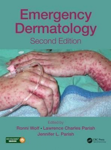 Emergency Dermatology, 2nd Edition