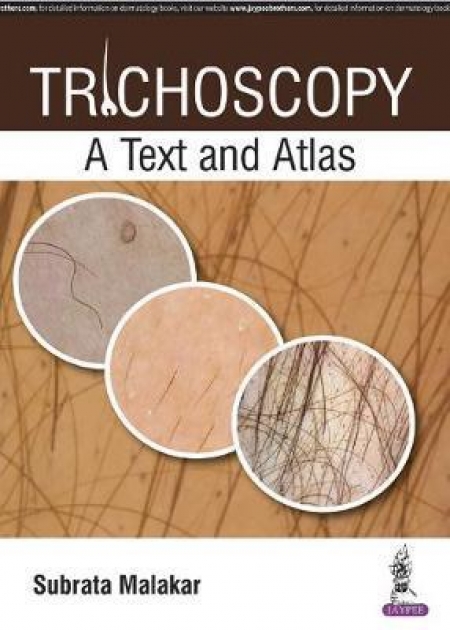 Trichoscopy : A Text and Atlas