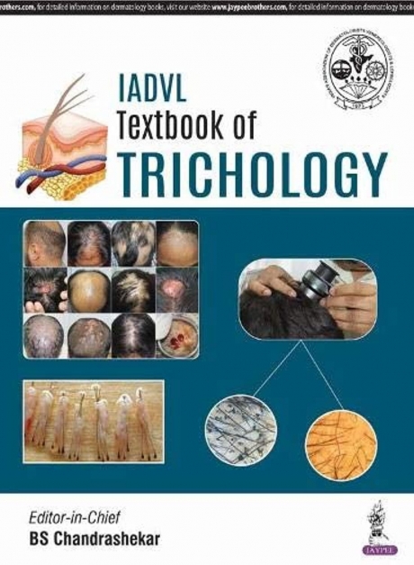 IADVL Textbook of Trichology, 1st Edition