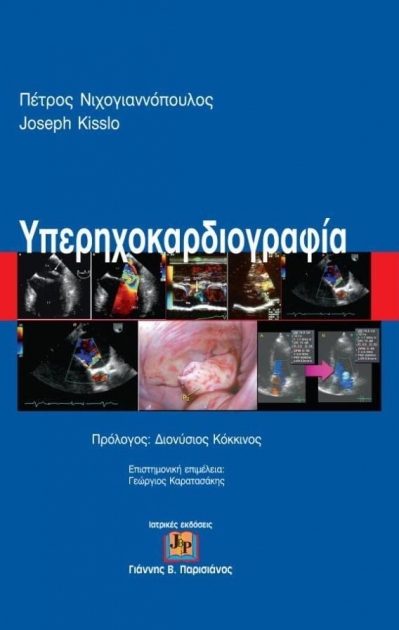 Υπερηχοκαρδιογραφία