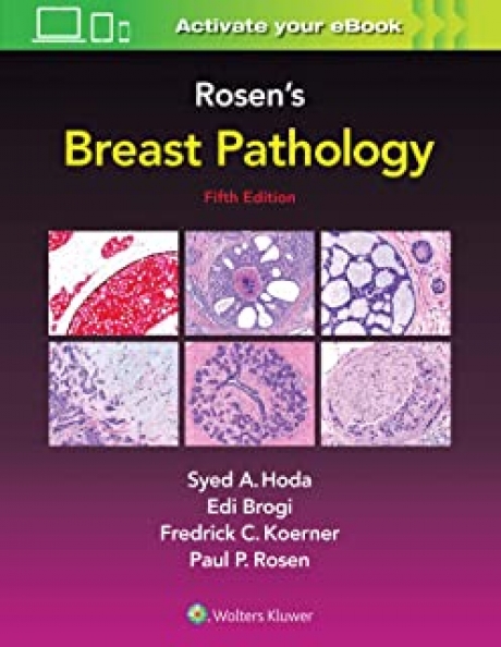 Rosen`s Breast Pathology, 5th Edition