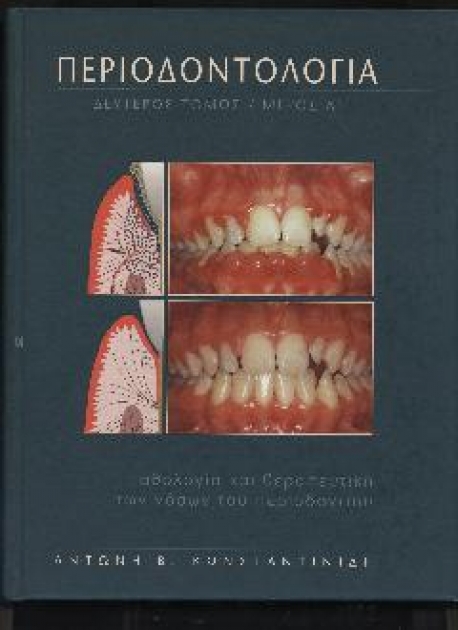 ΠΕΡΙΟΔΟΝΤΟΛΟΓΙΑ Β` Τόμος Α` Μέρος Παθολογία και Θεραπευτική των Νόσων του Περιοδοντίου