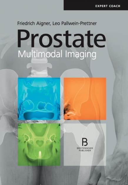 Prostate Multimodal Imaging