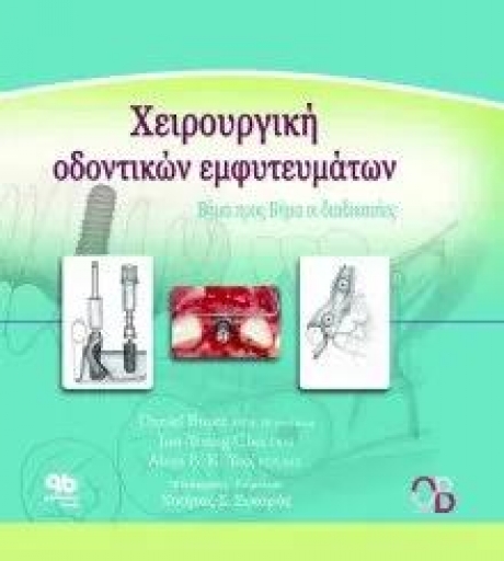Χειρουργική Οδοντικών Εμφυτευμάτων, Βήμα προς βήμα οι διαδικασίες