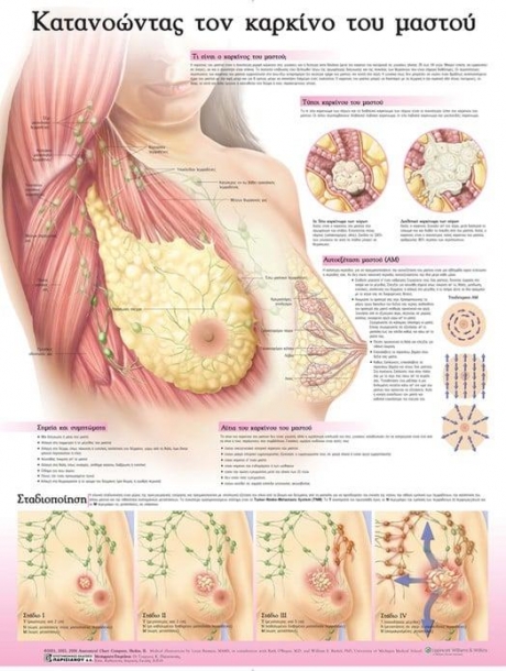 Ανατομικός Χάρτης: Κατανοώντας τον Καρκίνο του Μαστού