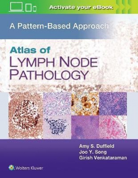 Atlas of Lymph Node Pathology A Pattern Based Approach, First edition