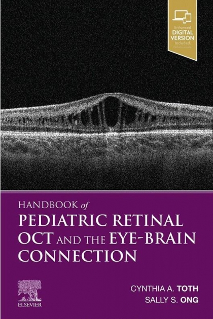 Handbook of Pediatric Retinal OCT and the Eye-Brain Connection1st Edition