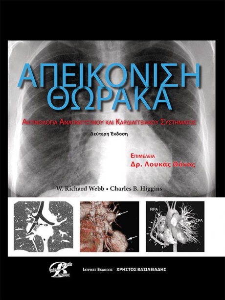 Απεικόνιση Θώρακα Webb: Ακτινολογία Αναπνευστικού και Καρδιαγγειακού Συστήματος, 2η `Εκδοση